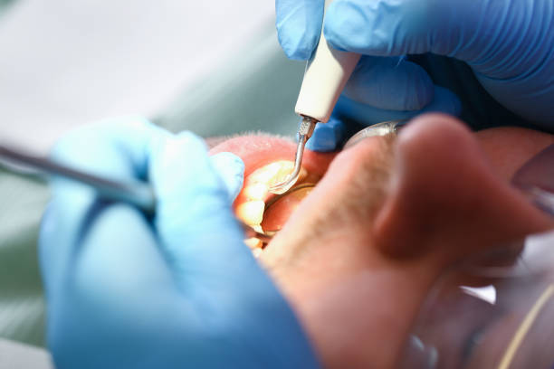 Best Knocked-Out Tooth Emergency  in Rossvle, IL
