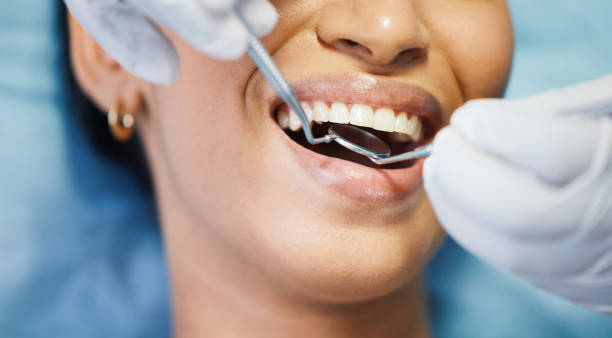 Best Knocked-Out Tooth Emergency  in Rossvle, IL